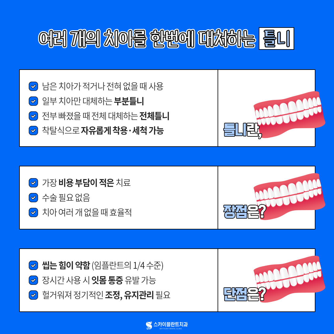 임플란트
