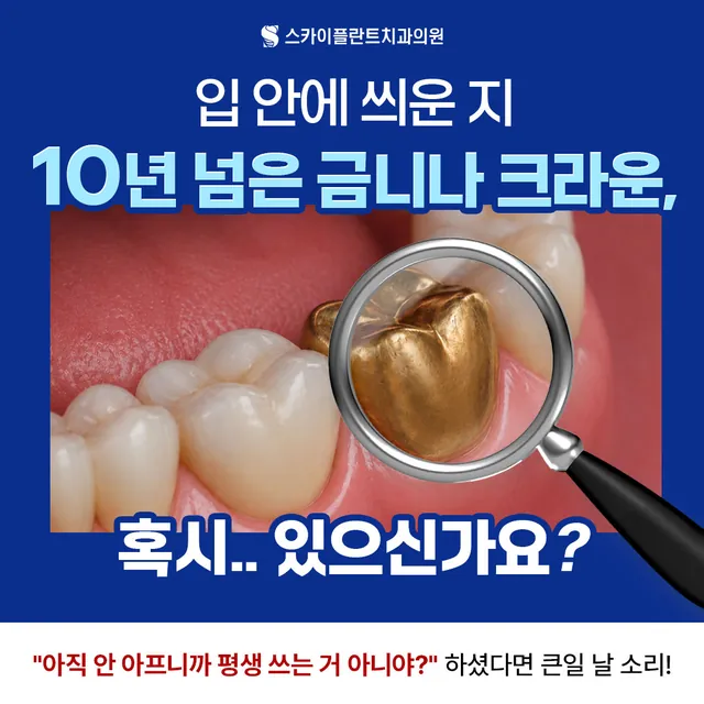 오래된 금니 크라운 교체 시기