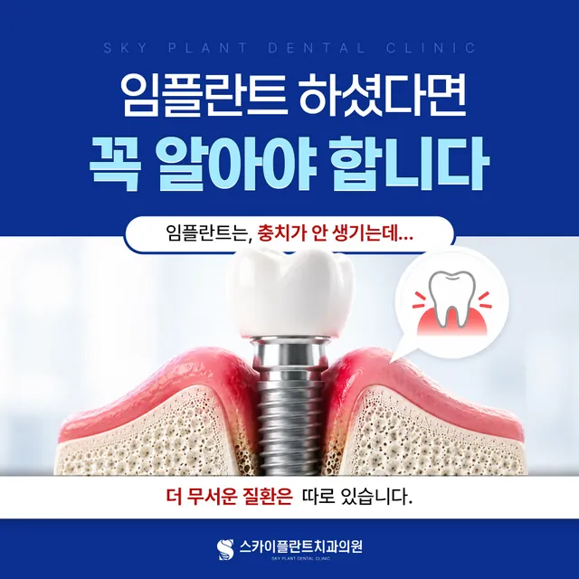 임플란트 관리법